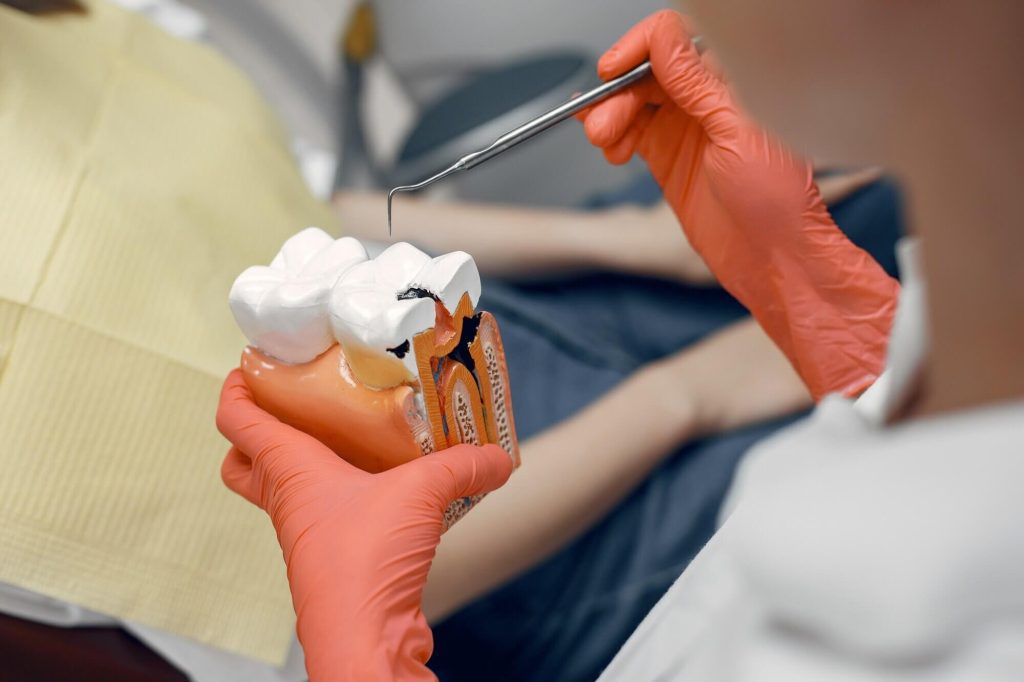 Root Canal Treatments
