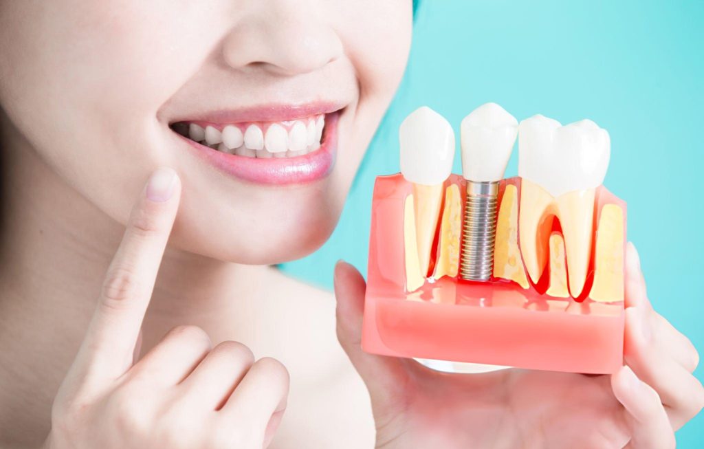 Regain Your Smile with Dental Implants in Bury St Edmunds & Thetford