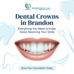 Dental Crowns in Brandon